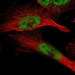 ZBTB11 Antibody, Novus Biologicals:Antibodies:Primary Antibodies